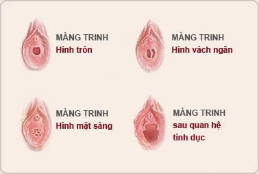 âm hộ phụ nữ